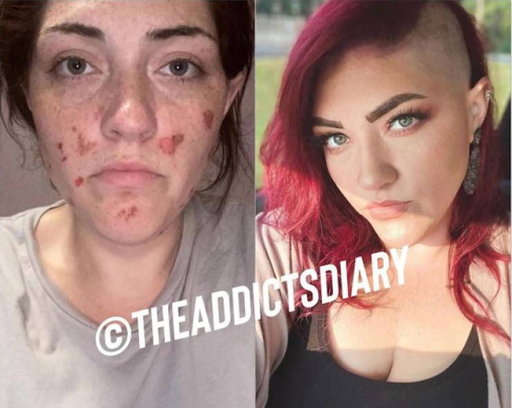 Incredibly Inspiring Drug Addict Transformations!