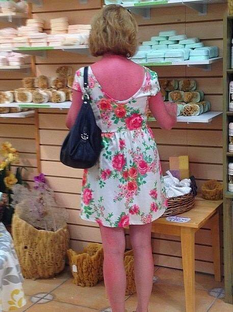 When Sunbathing Goes Wrong…