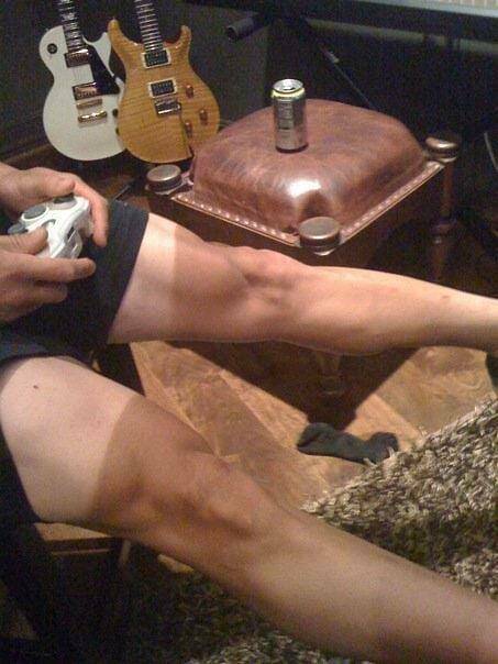 When Sunbathing Goes Wrong…