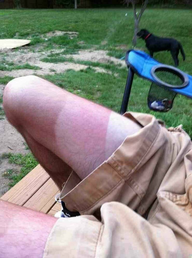 When Sunbathing Goes Wrong…