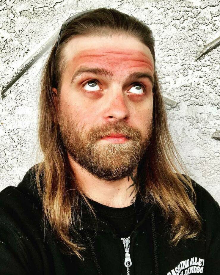 When Sunbathing Goes Wrong…