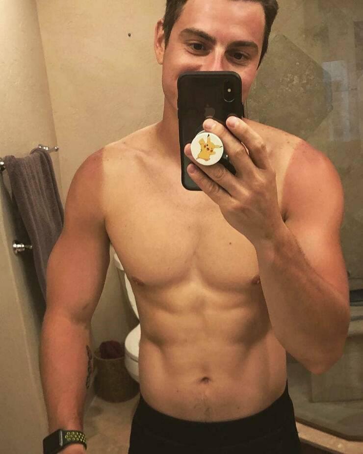 When Sunbathing Goes Wrong…