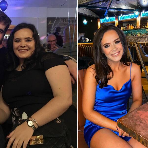 Girl Loses 37 Kilos… And Her Happiness