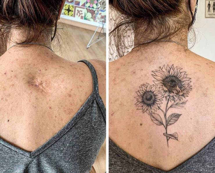 People Covering Their Scars In Cool Fashion