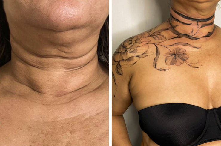 Artist Saves People’s Scars By Tattooing Over Them