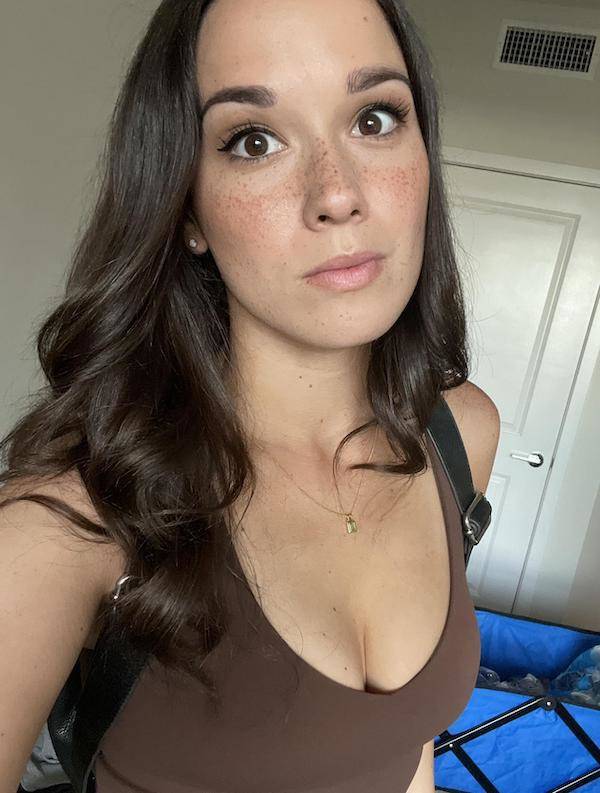 The Charm Of Freckled Faces