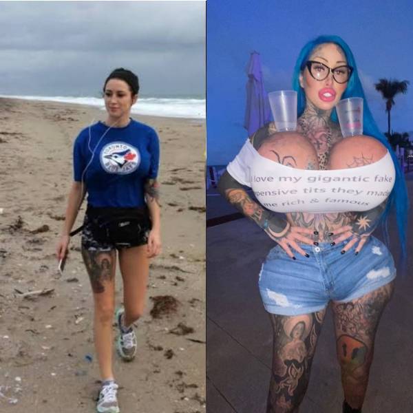 Only One Boob Left...
