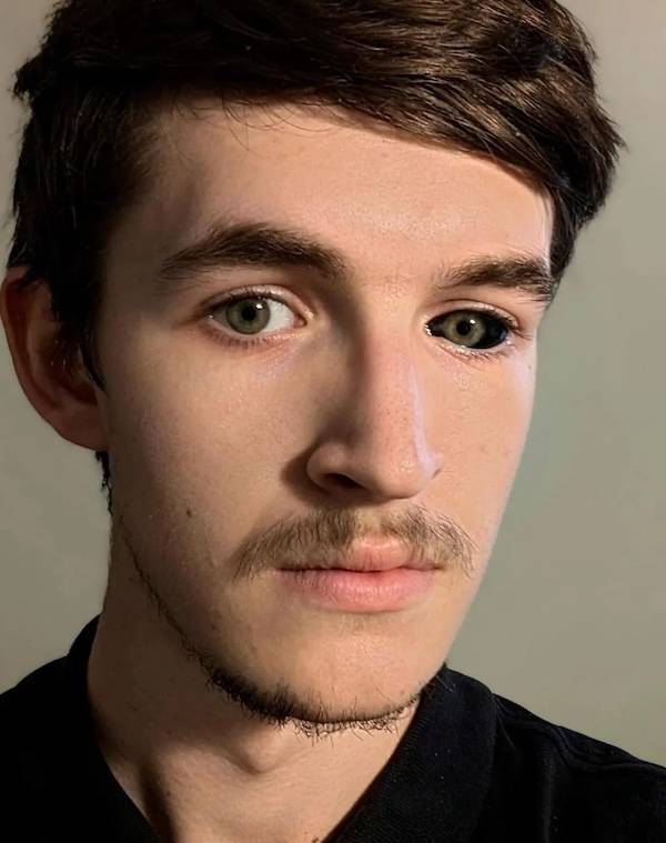 strange black eyes