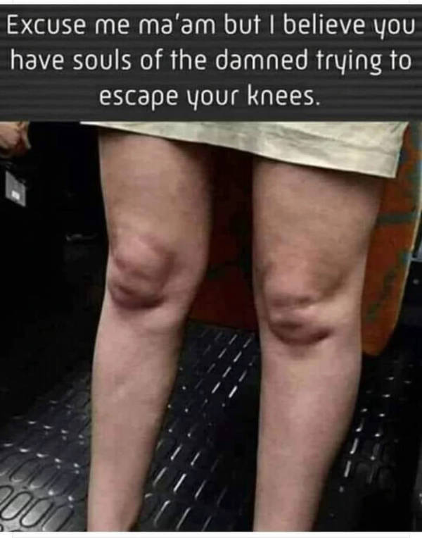 Content Image