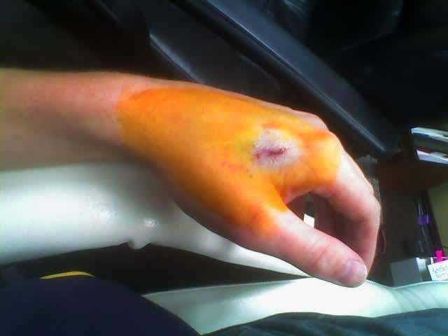 People, Never Get This Far In Body Modifications!
