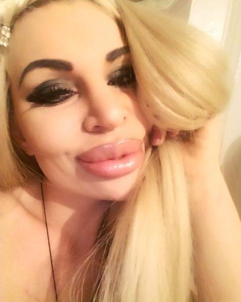 She Had To Admit That Last Plastic Surgery To Be Her Life’s Biggest Failure