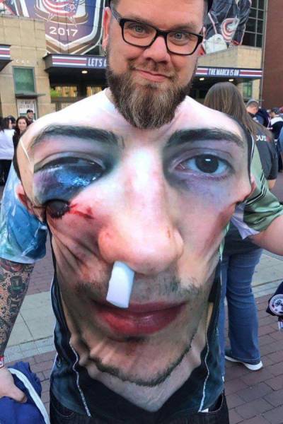 Content Image