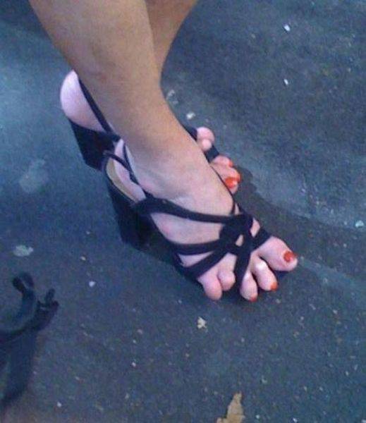 Pictures That Will Make You Cringe