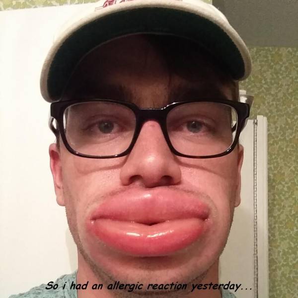 Content Image