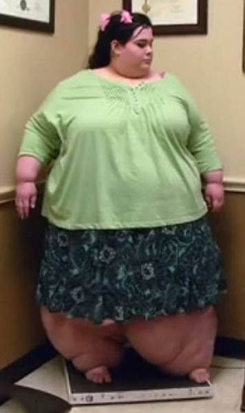 When Dedication Triumphs Over The Obesity