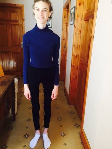 From Anorexia To An Amazing Body!