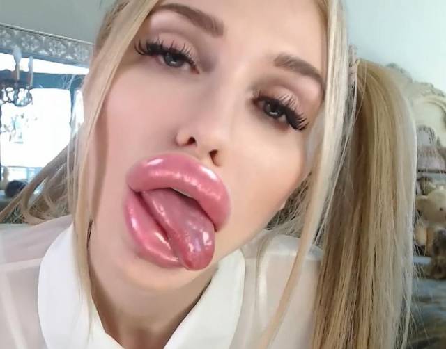 Content Image
