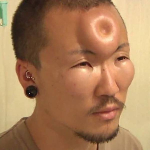 Content Image