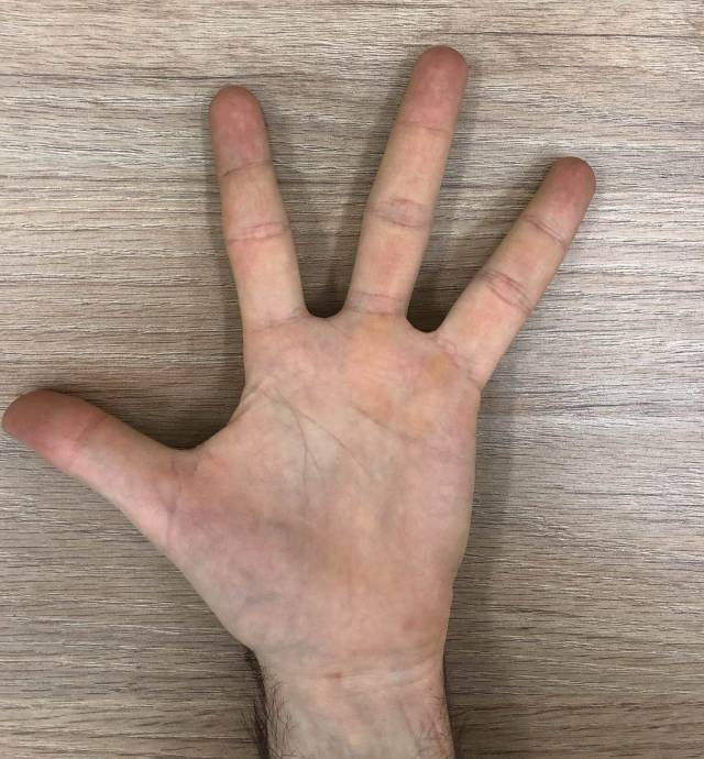 Content Image