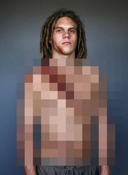 Car Crash Survivors Show The Importance Of Wearing A Seatbelt In A Powerful Social Campaign