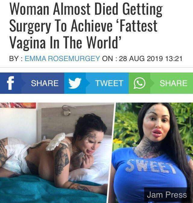 Content Image
