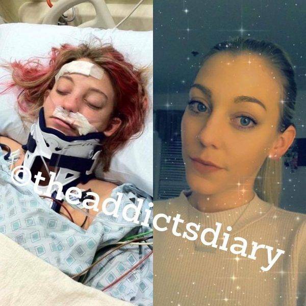 Drug Addicts Have A Chance!