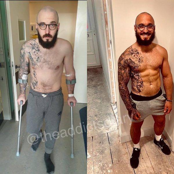 Drug Addicts Have A Chance!