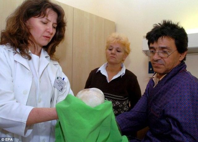 Kidney stone (3 pics)