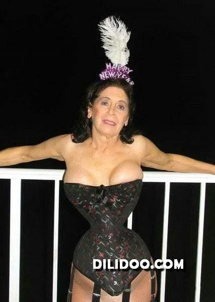 When plastic surgery fails (38 pics)