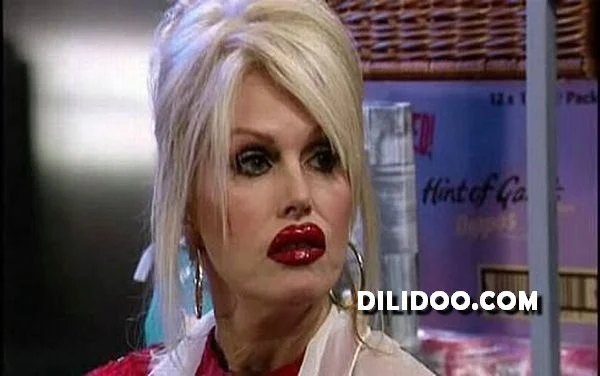 When plastic surgery fails (38 pics)