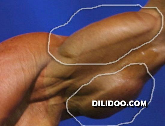 When plastic surgery fails (38 pics)