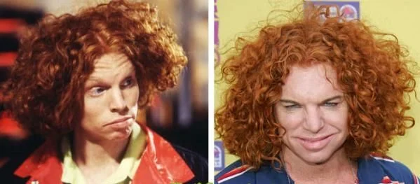 When plastic surgery fails (38 pics)