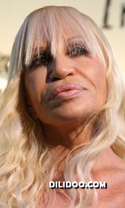 When plastic surgery fails (38 pics)