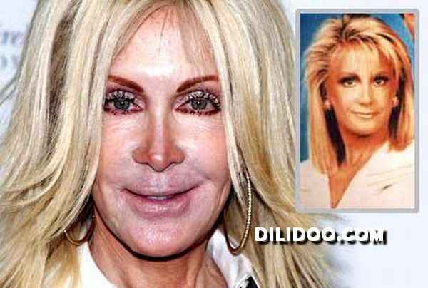 When plastic surgery fails (38 pics)