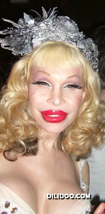 When plastic surgery fails (38 pics)