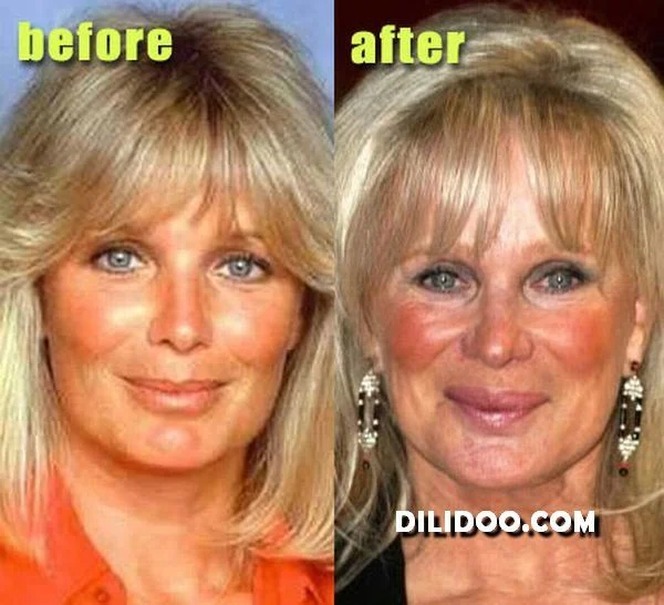 When plastic surgery fails (38 pics)