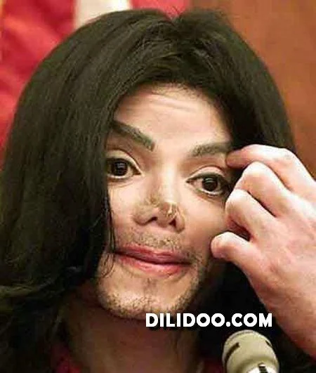 When plastic surgery fails (38 pics)