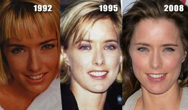 When plastic surgery fails (38 pics)