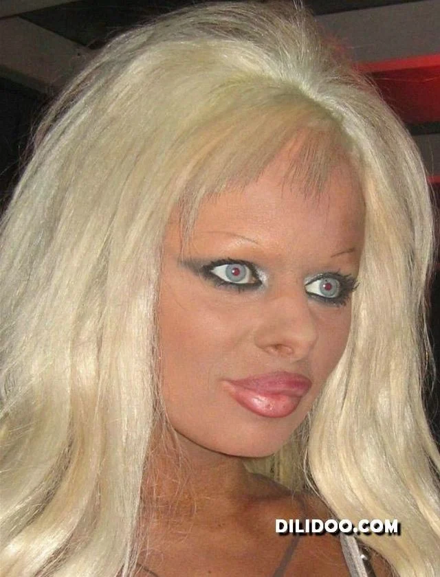 When plastic surgery fails (38 pics)