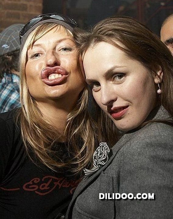 When plastic surgery fails (38 pics)