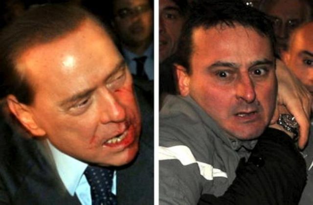 Berlusconi Gets a Broken Nose and Loses Two Teeth during the Assault (7 pics+1 video) Berlusconi Gets a Broken Nose and Loses Two Teeth during the Assault (7 pics+1 video)