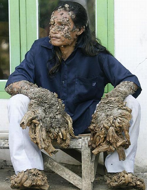 Have You Ever Seen a Tree Man? (19 pics) Have You Ever Seen a Tree Man? (19 pics)