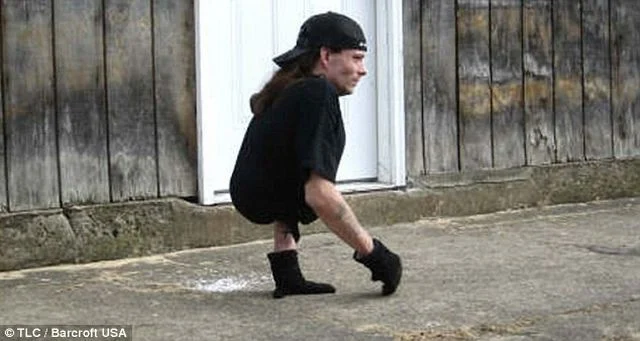 The Man with Half a Body! (33 pics)