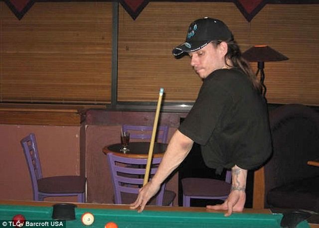 The Man with Half a Body! (33 pics)