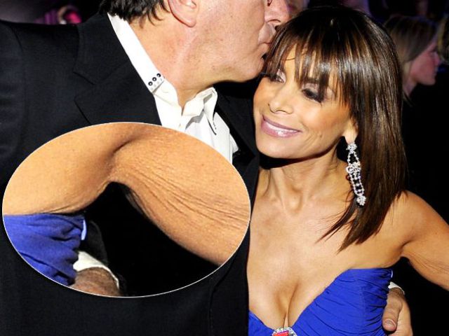 Celebrities Aren&rsquo;t Perfect (31 pics)