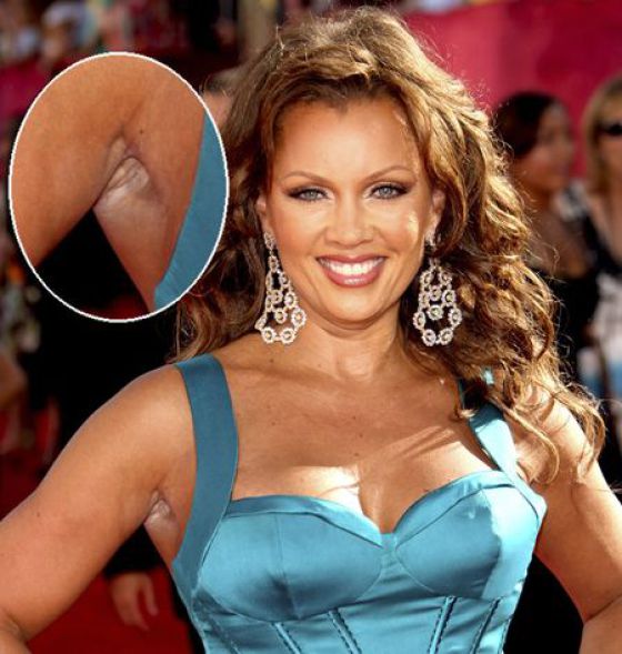 Celebrities Aren&rsquo;t Perfect (31 pics)