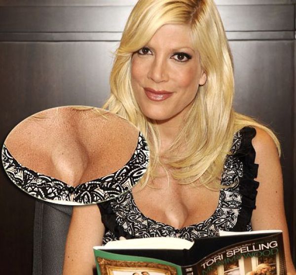 Celebrities Aren&rsquo;t Perfect (31 pics)