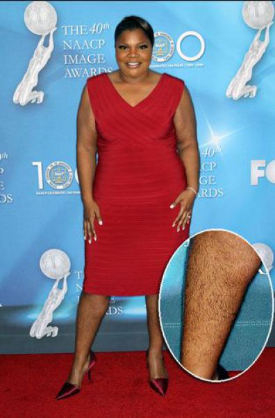 Celebrities Aren&rsquo;t Perfect (31 pics)