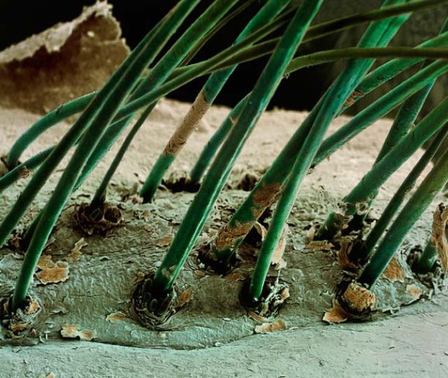 Amazing Scanning Electron Microscope Pictures