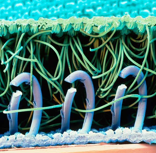 Amazing Scanning Electron Microscope Pictures